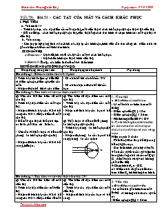 Giáo án Vật lý nâng cao 11 - Tiết 78 - Các tật của mắt và cách khắc phục